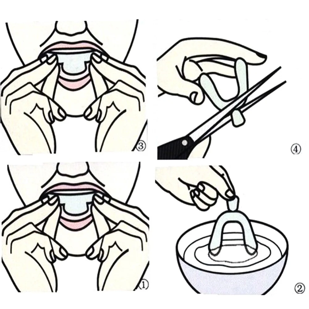 2/4pcs Silicone Orthodontic Braces Dental Teeth Whiten Braces Bleaching Molding Trays Custom Moldable Thermoform Teeth Corrector