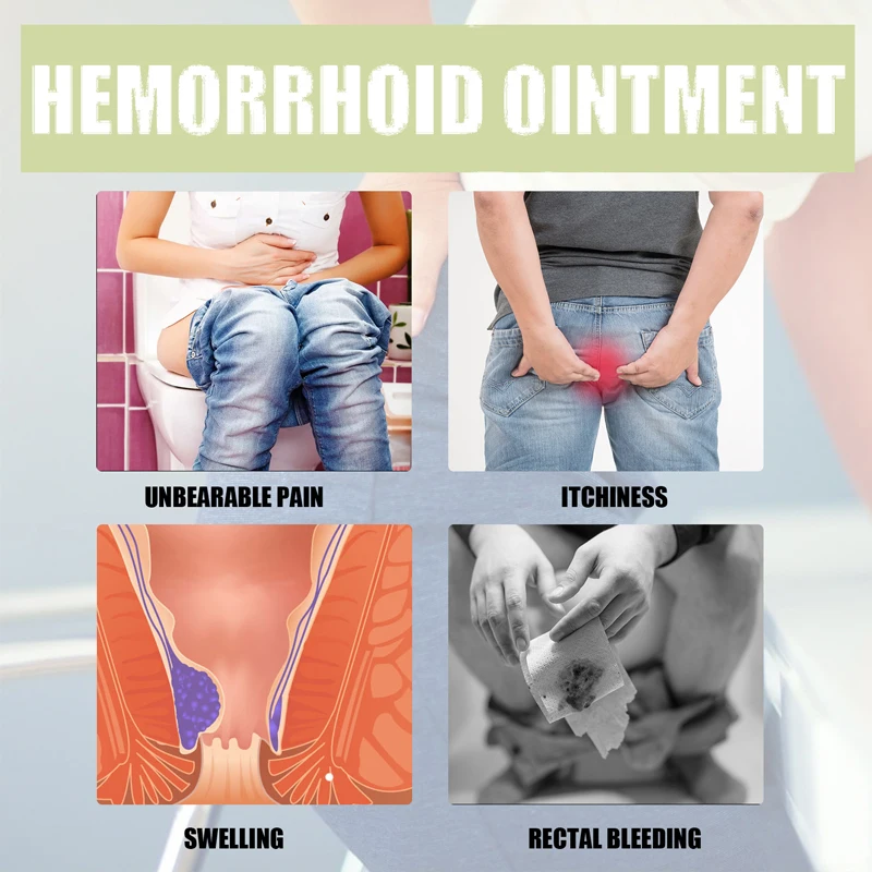 Hemorrhoids Ointment Skin Care Ointment Pain Relief Cream For Internal Hemorrhoids External Hemorrhoid Relief Cure Anal Fissure 3Boxes