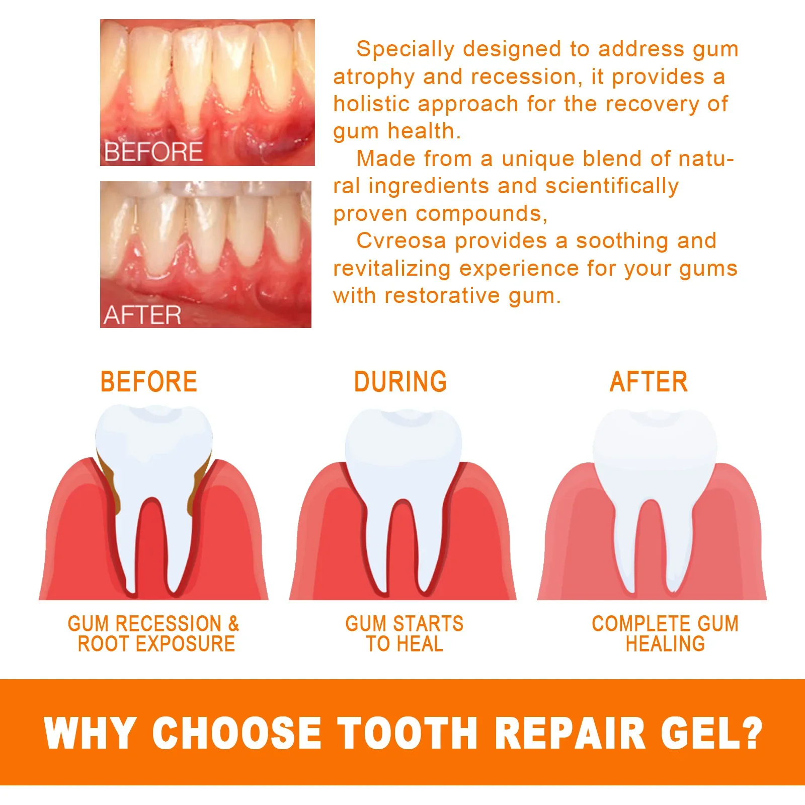 Tooth Gum Serum Repair Anti Gingival Atrophy Recession Inflammation Discomfort Disease Remove Stain Oral Whitening Teeth Essence teeth whitening strips,teeth whitening toothpaste,teeth whitening powder,teeth whitening kit,teeth whitening gel