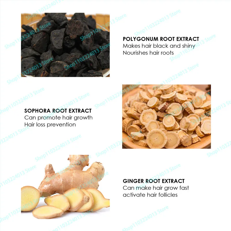 Description Picture 4 of itemFast Hair Growth for Men Women Hair Oil Care Ginger Anti Hair Loss Scalp Treatment Grow Serum Products Beauty Health