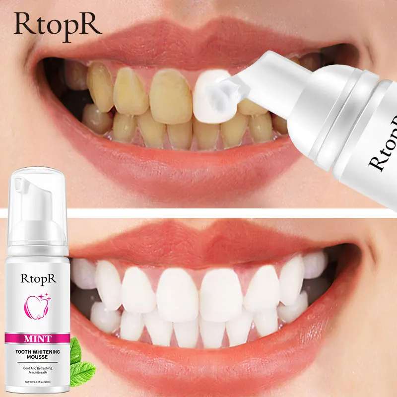 RtopR Teeth Whitening Toothpaste Remove Plaque Stains Serum Dental Bleaching Tools Oral Hygiene Cleaning Fresh Breath Tooth Care