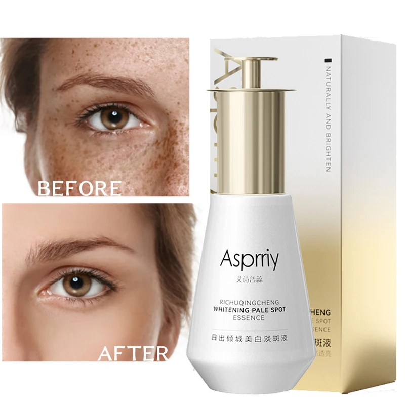 35ml Fade Dark Spot Corrector Skin Lightening Blemish Removal Serum Reduces Age Spots Pigmentation Brighten Even Skin Tone