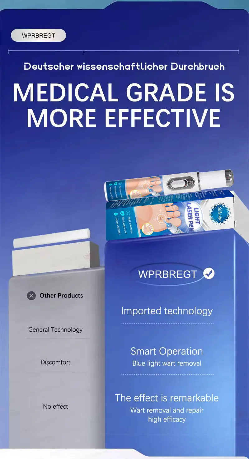 Penna a luce blu a massima potenza per la rimozione di verruche comuni e plantari, strumento per la cura delle verruche._voghion.com