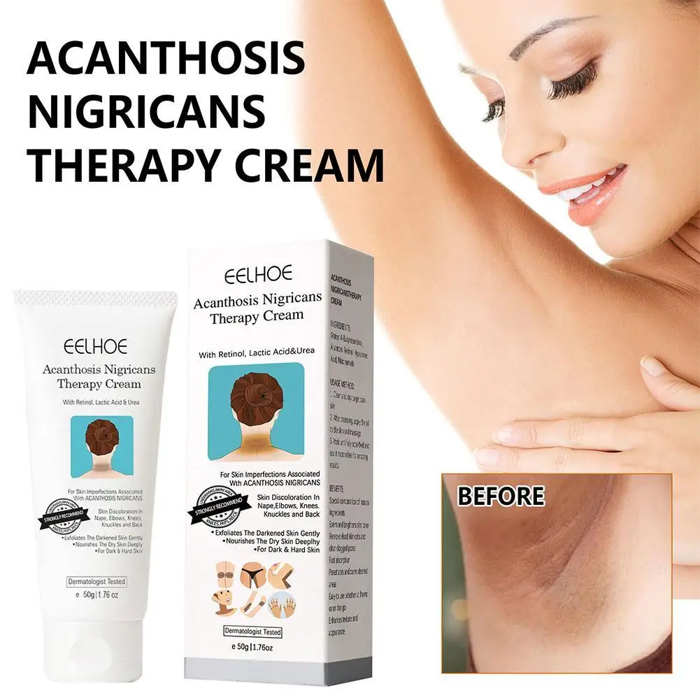 

Black Spine Skin Repair Cream For The Treatment Of Black Spine Skin Disease: Oil Joint Blackening And Blackspot Removing