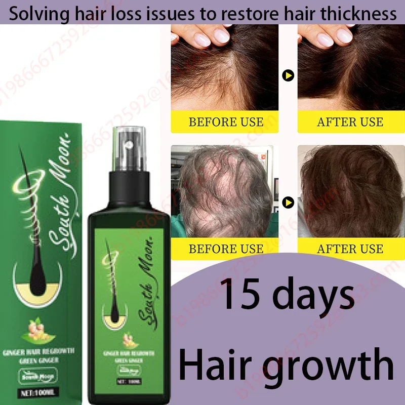 

PURC Fast Hair Growth Products for Men Biotin Anti Hair Loss Oil Shampoo Conditioner Set Hair Treatment for Women Beauty Health