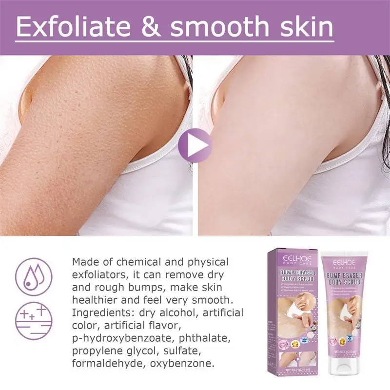 Keratosis Pilaris Kräm Närande Återfuktande För Jordgubbsben Ta bort KP Bump Eraser Kroppsskrubb Kroppshudvård_voghion.com