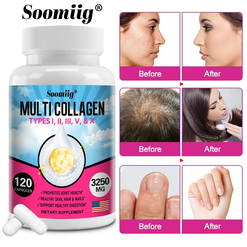 

Soomiig Collagen Complex - Types I, II, III, V, X with Vitamins and Biotin, Grass Fed, Non-GMO, Supports Hair, Skin, Nails
