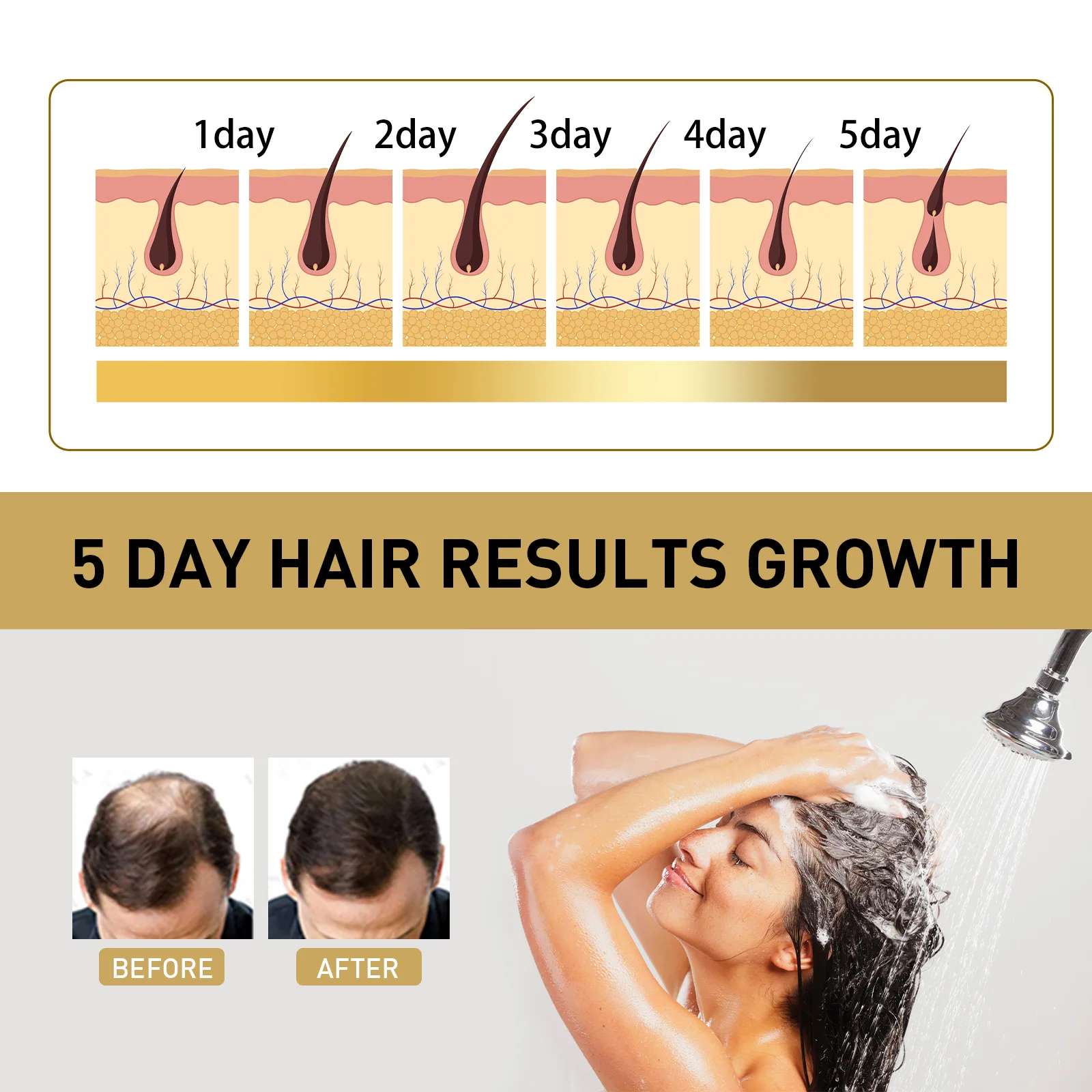 Ginger Regrowth Shampoo Anti Hair Loss Oil Control Dandruff Removal Moisturiz Nourish Scalp Repair Damaged Hair Growth Shampoo 6