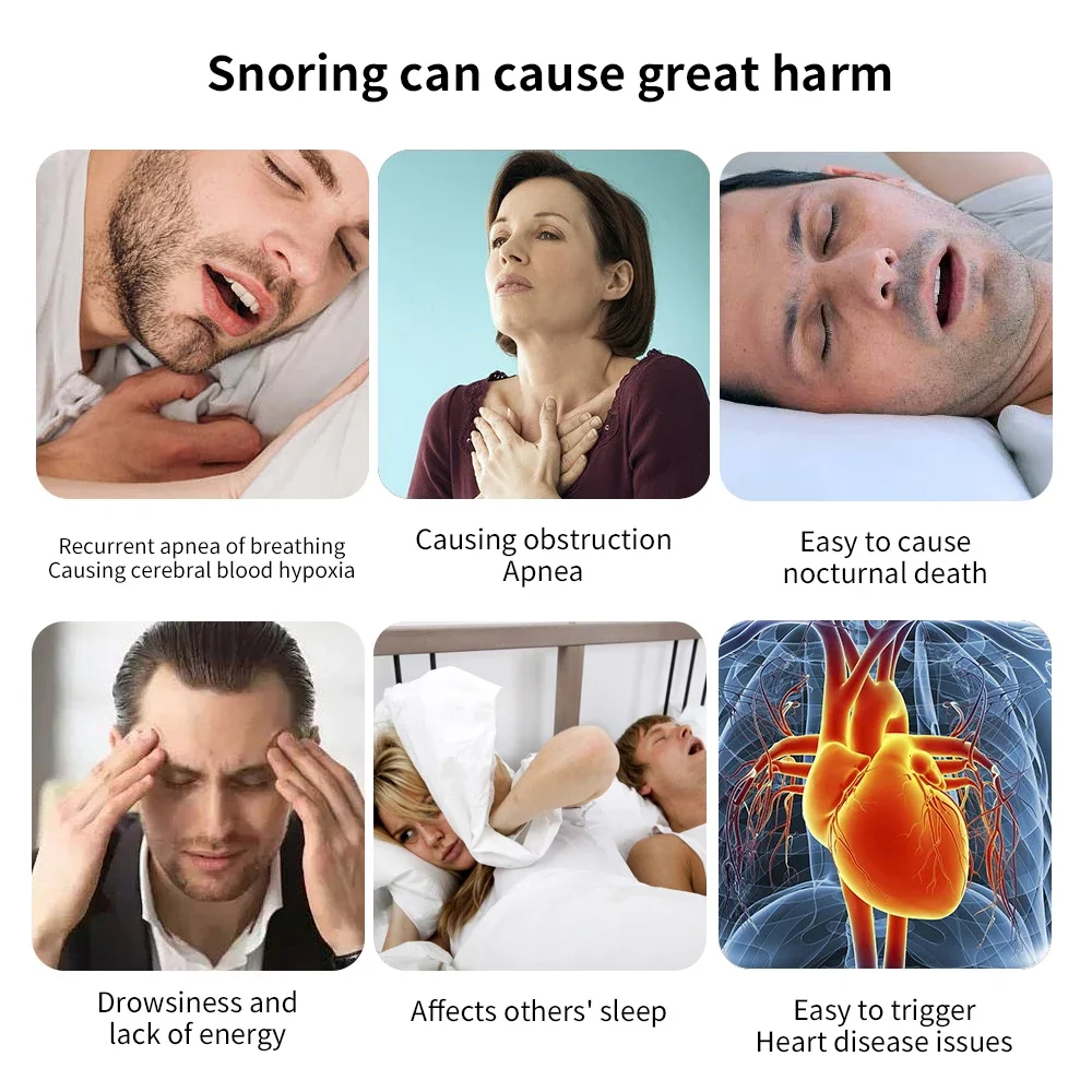 Electric Anti-snoring Device Vibration Pulse Household Breathing Corrector Sleep Corrects Snoring Avoid Harming USB Charging