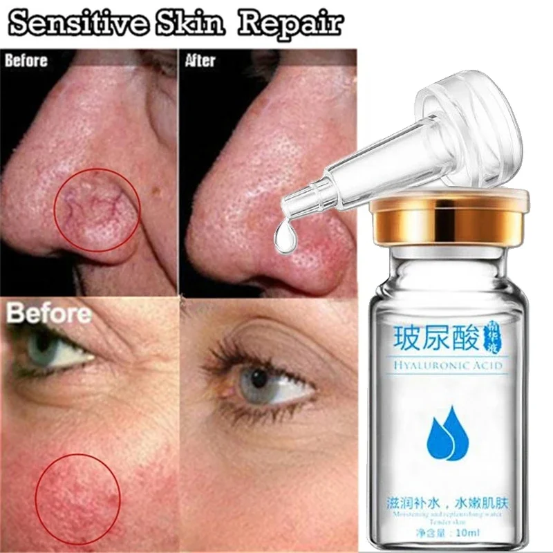 

Эфирное масло с гиалуроновой кислотой, 10 мл