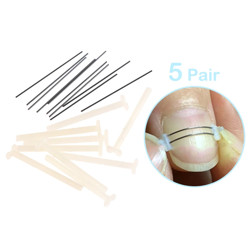 

Ingrown Toenail Corrector Tools Pedicure Recover Embed Toe Nail Treatment Professional Ingrown Toenail Correction Foot CareTool