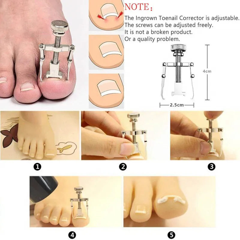 12Pcs/set Professional Pedicure Tools Ingrown Toenail Tools Kit Nail Care Ingrown Toenail Removal Correction Clippers Foot Care BEST SELLERS