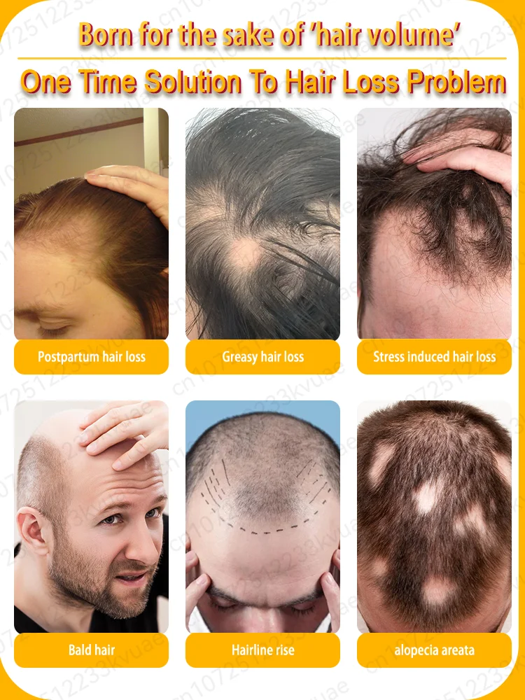 Produits croissance des cheveux dites adieu calvitie perte de cheveux 99% avis positifs