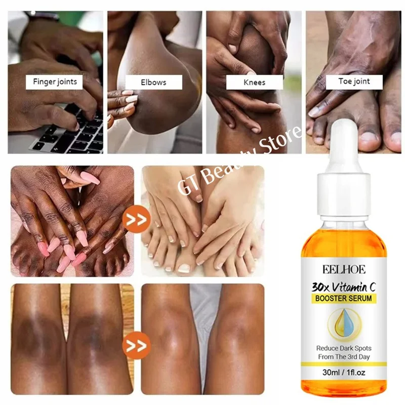 Dark Knuckles Fast Brighten Serum Elbows Hand Knuckle Brightening Serum Knee Black Skin Quickly Lighten Stains Remover Essence 3