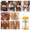 Dark Knuckles Fast Brighten Serum Elbows Hand Knuckle Brightening Serum Knee Black Skin Quickly Lighten Stains Remover Essence 3