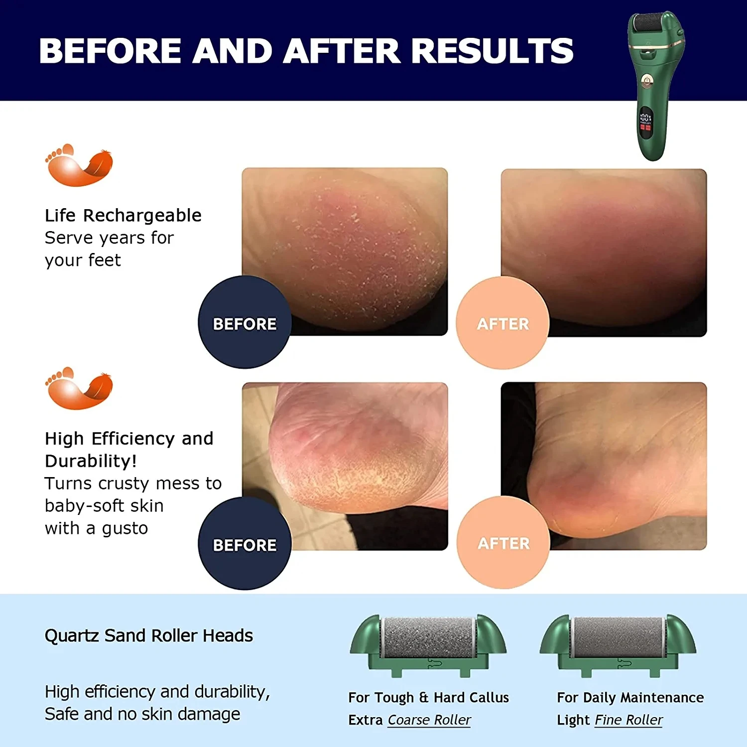 Professional Electric Feet Callus Remover,IPX7 Waterproof Portable Electronic Foot Scrubber Pedicure Kit for Removing Dead Hard 6