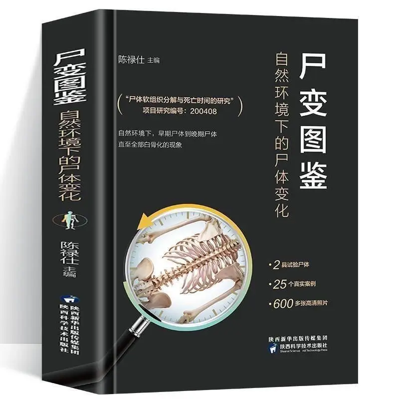 Атлас автопсии, кадаверические