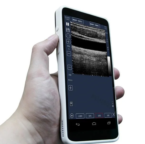 

Sonography portable ultrasound desktop gynecology obstetric suppliers ultrasound protable price ultrasound instruments