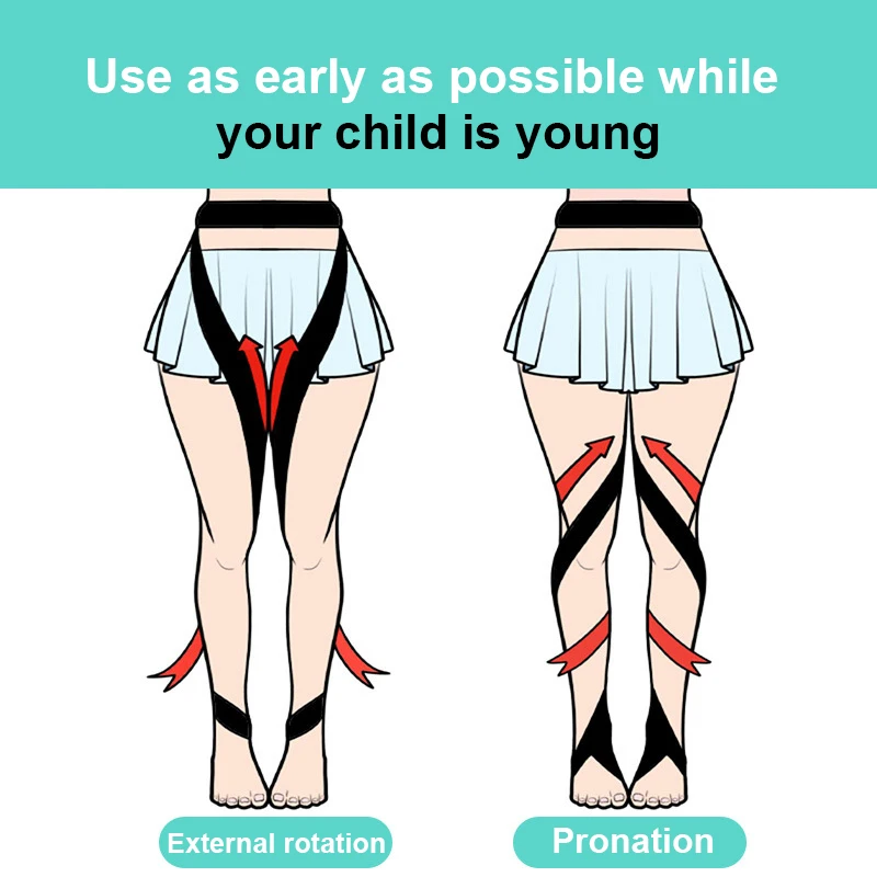 Portable Children's Leg Corrector Baby XO Type Correction Belt Leg Foot Internal Rotation External Rotation Correction Belts New