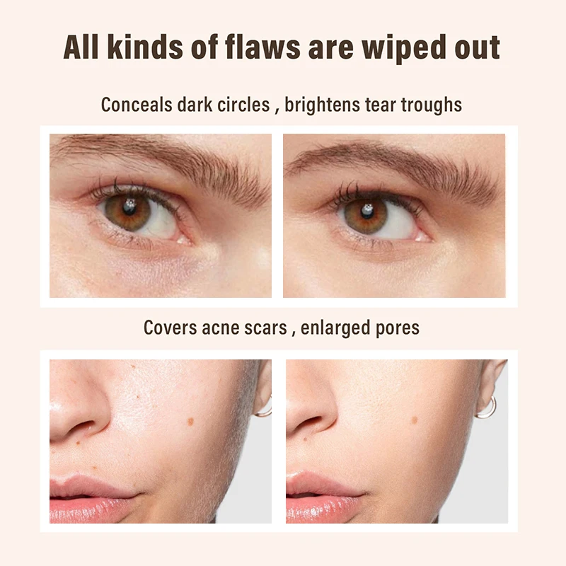 6 Colors New Concealer For Dark Circles, Tears, Freckles, Acne, Dark Circles, Pigmentation And Blemishes - Creating A Natural_voghion.com