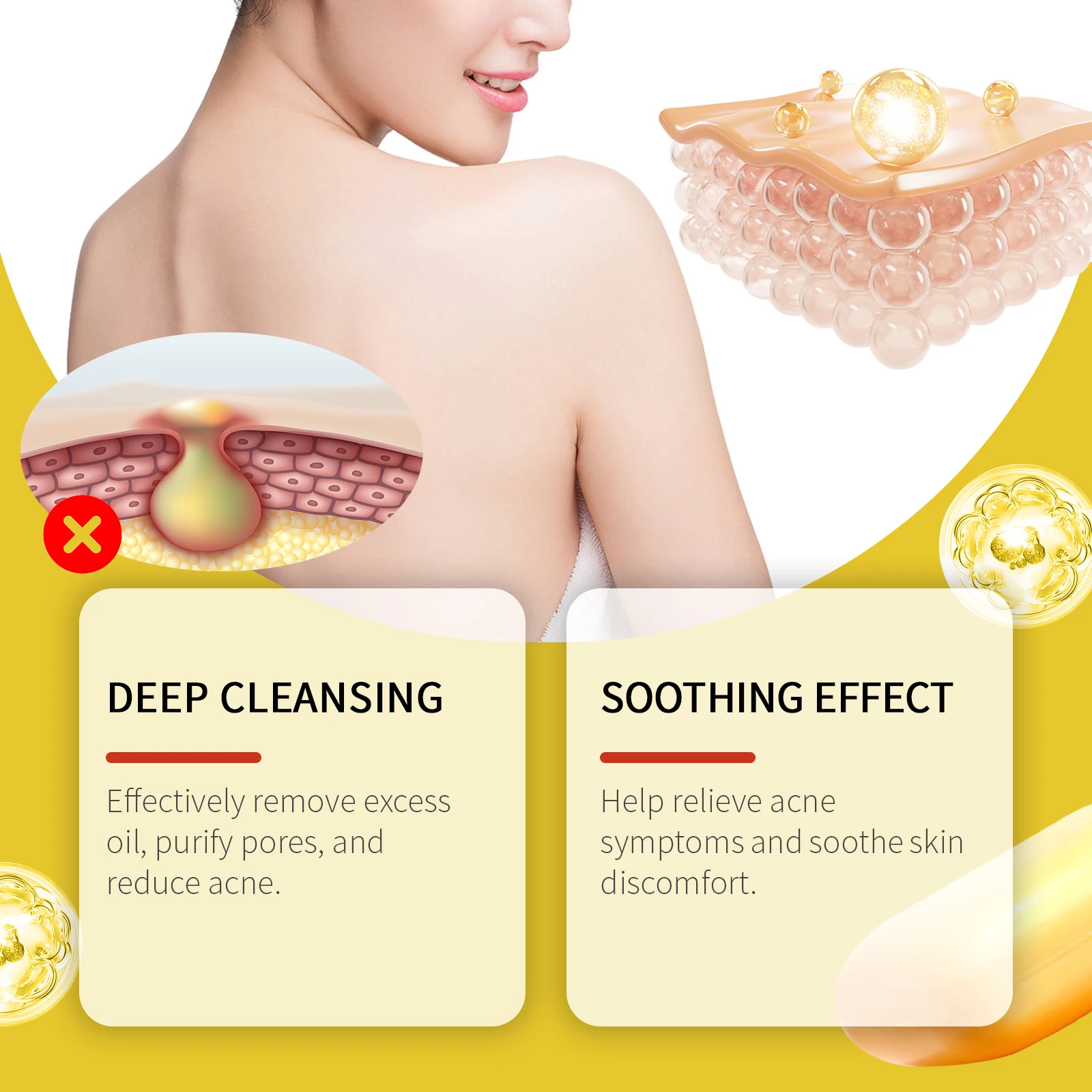 Acne Treatment Soap Pimple Remove Pigment Deep Cleansing Pores Shrink Oil Control Moisturize Body Face Lightening Skin Care Soap 3