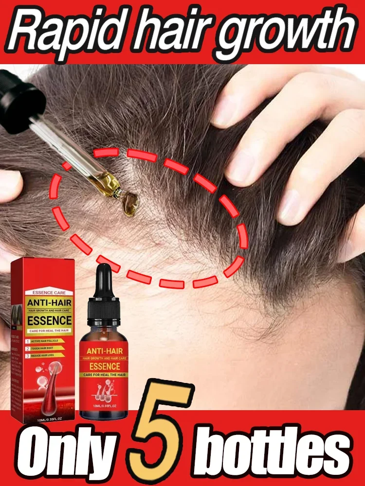 

Unisex Hair Growth Oil Hair Loss Treatment Rapid Effective Baldness Repair Hereditary Postpartum Hair Loss