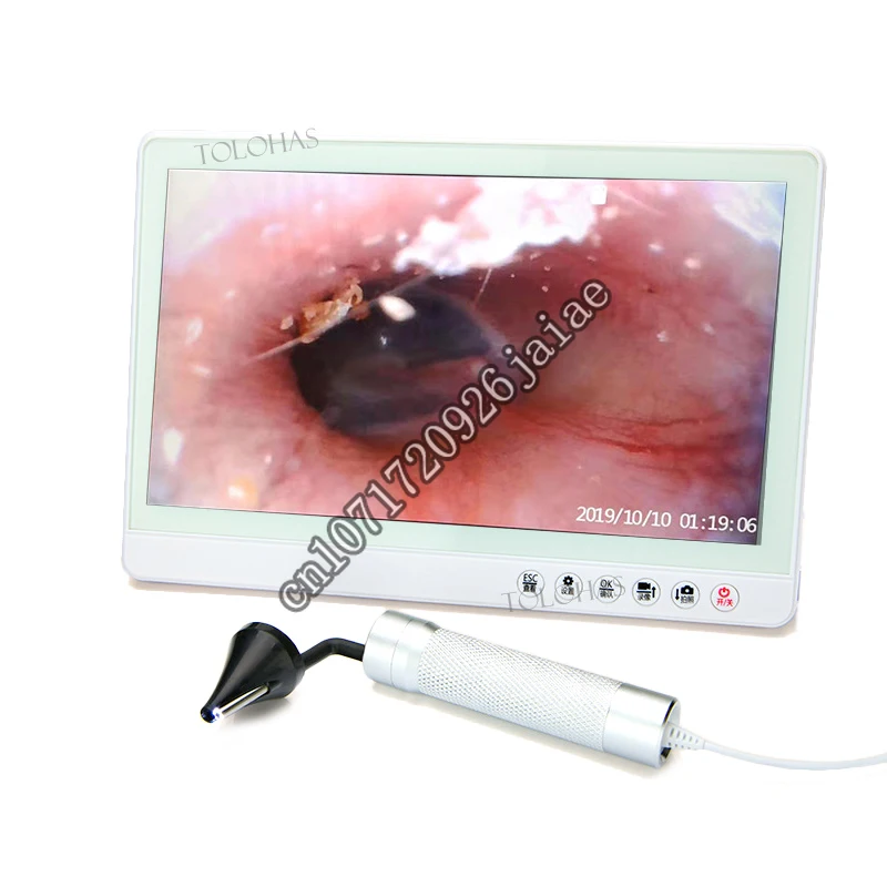 

LHGK03 Digital ENT Ear Endoscope Otolaryngology Examination Eardrum Visible Video Otoscope Set