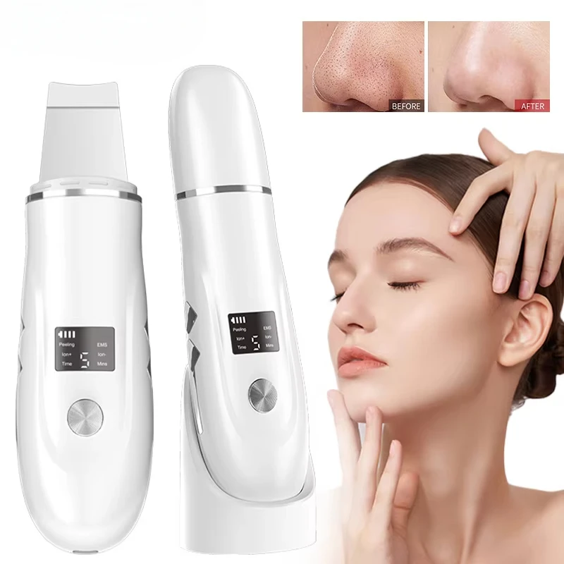 Electric Ultrasonic Skin Scrubber Peeling Shovel Blackhead Remove Pores Deep Cleaning Peeling Sholve Skin Care Face Lifting