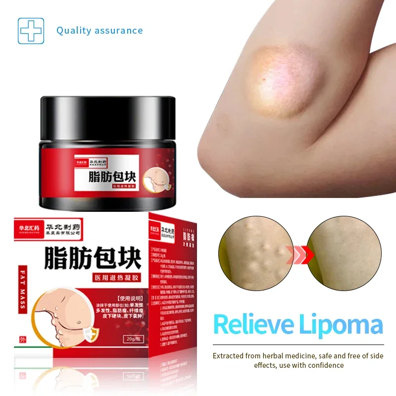 Lipoma Removal Soothing Cream Relief Pain Fibroma Subcutaneous Fat Lumps Remover Spray Cellulite Treatment