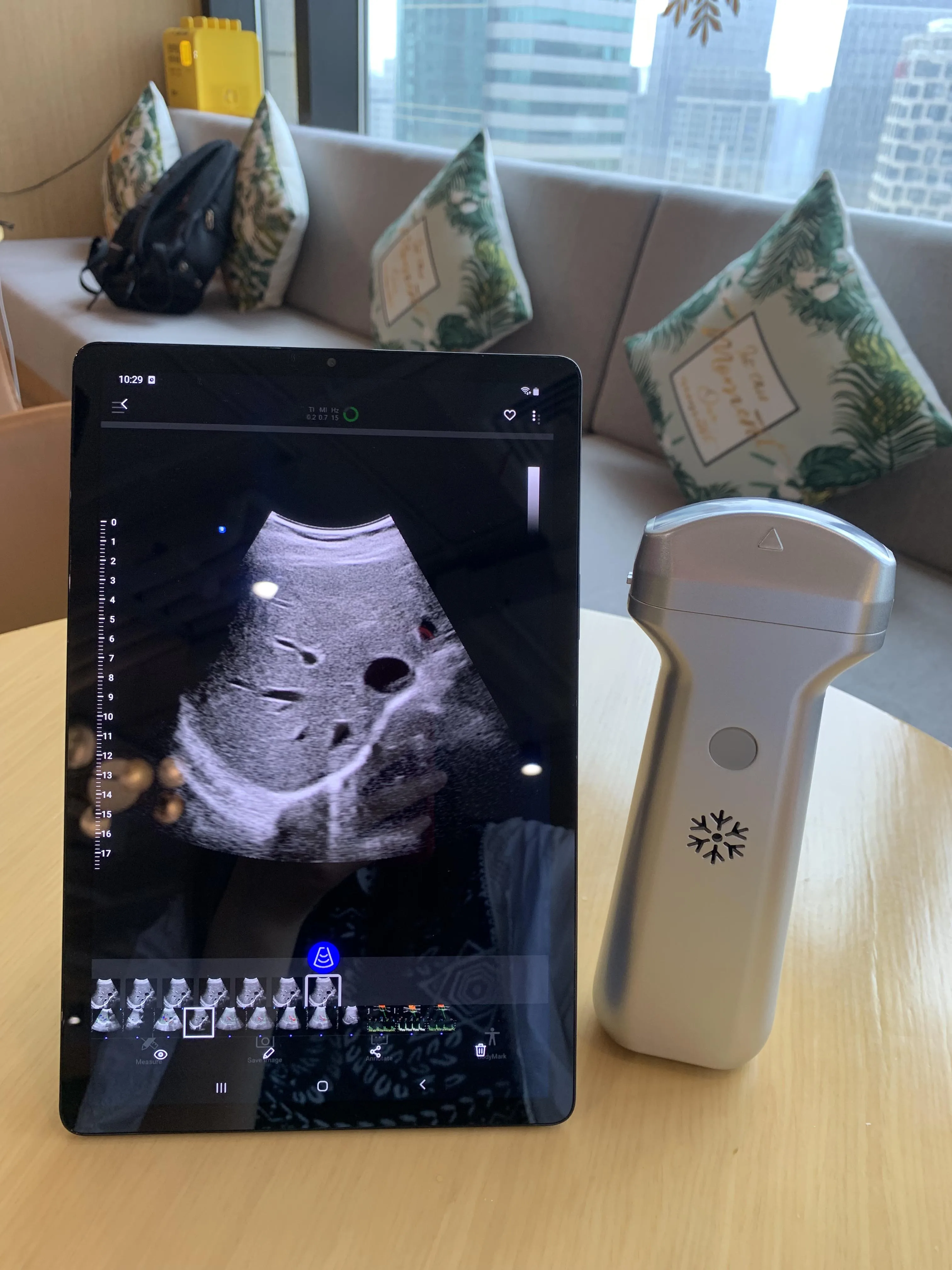 Рисунок 4 - Портативный беспроводной цветной Доплер