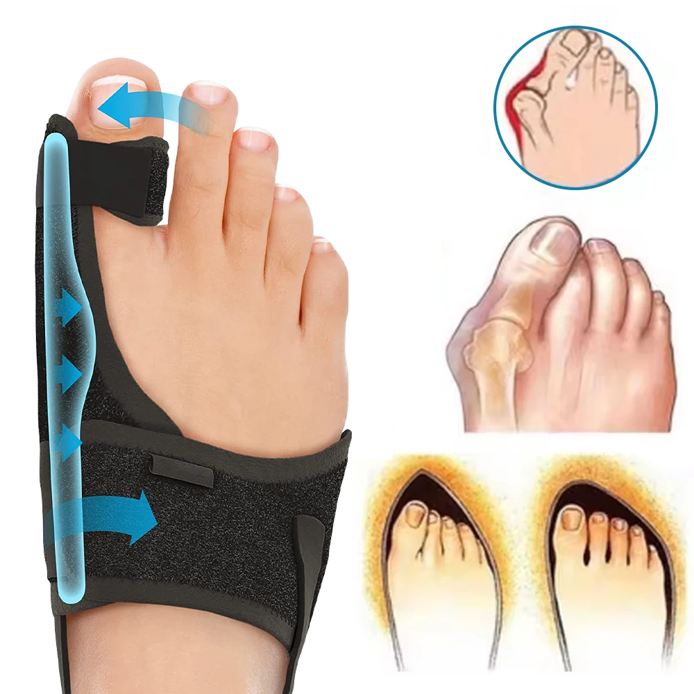 Foot Corrector Bunion Splint Hallux Valgus Correction Big Toe Straightener Orthopedic Corrector Pedicure Bunion Protector Toes