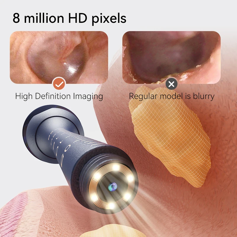 upgraded smart visual ear wax cleaner with camera 800w hd endoscope multi functional visual ear cleaning tool includes storage Upgraded Smart Visual Ear Wax Cleaner With Camera 800W HD Endoscope Multi-Functional Visual Ear Cleaning Tool Includes Storage 6