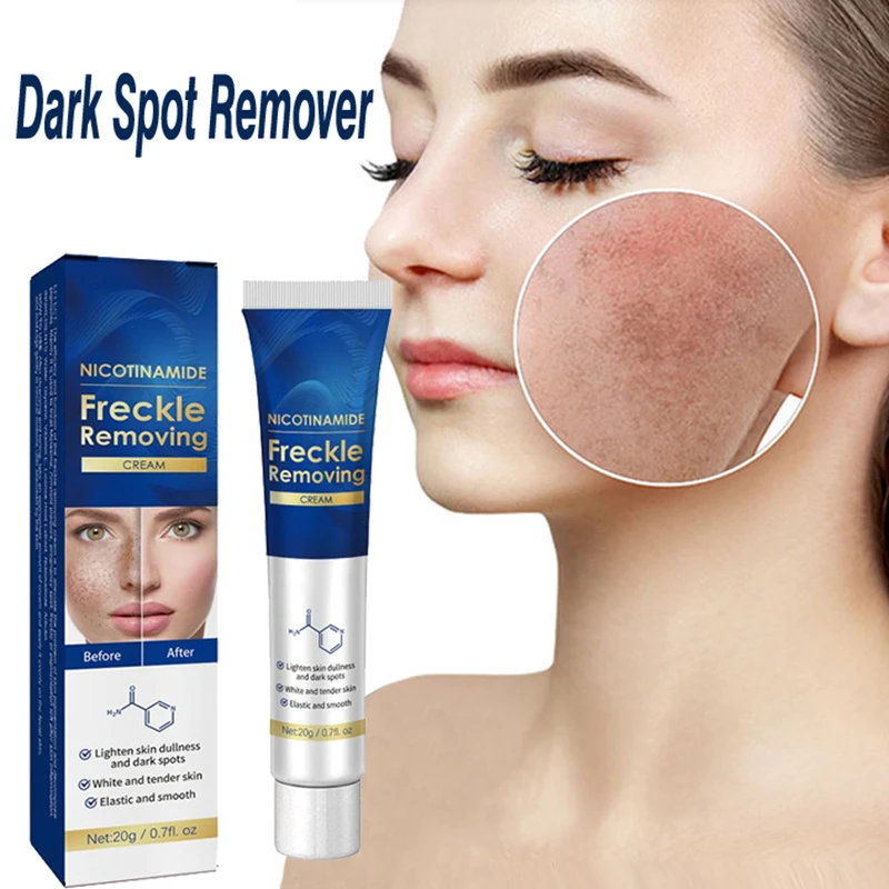 

Средство для удаления темных точек на лице, бактора, сырые таблички, солнечные ожоги, циазма, хориолет, крем для веснушек