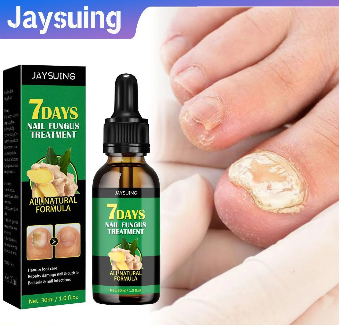 Uñas Toenail Care Solution Natural Nail Essence Fix Renew Damaged Molds Nail Broken Cracked Discolored Nails Fast Repair Serum