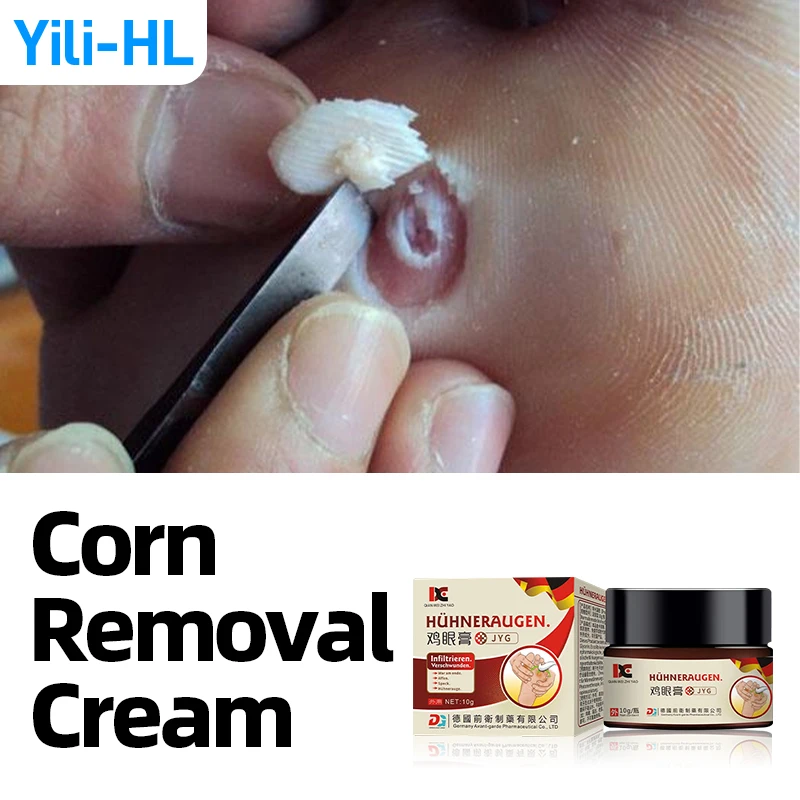 

Corn Removal Cream Foot Corns Treatment Medicine Wart Calluses Callosity Plantar Warts Remover Feet Care German Secret Recipe