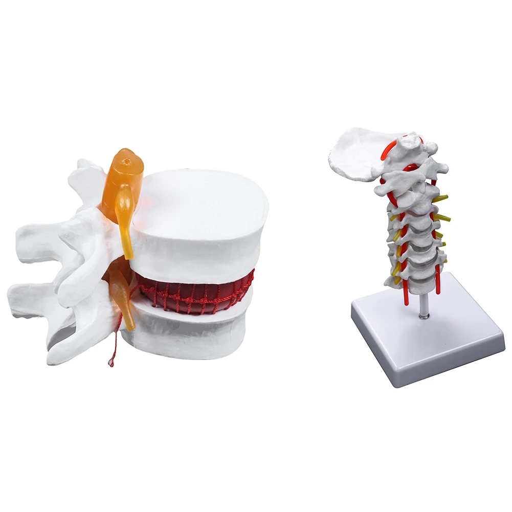 

1 Pcs Human Anatomy Skeleton Spine Lumbar Disc Teaching Model & 1 Pcs Cervical Vertebra Arteria Spine Nerves Model