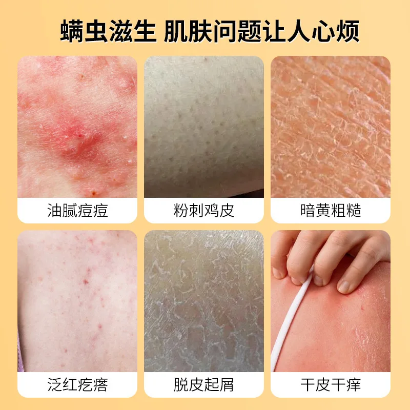 Shower Gel 400ml Sulfur Liquid Mite Removal Soap Cleaner Bar Soap Acne Treatment Reduce Oil Keeps Pores Cleaner Hand Sulfur body wash