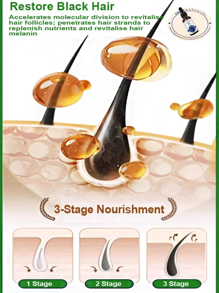 Natural Anti Gray Hair Serum-Repair White & Darkening Hair Nourishing Care Remedy anti gray hair serum