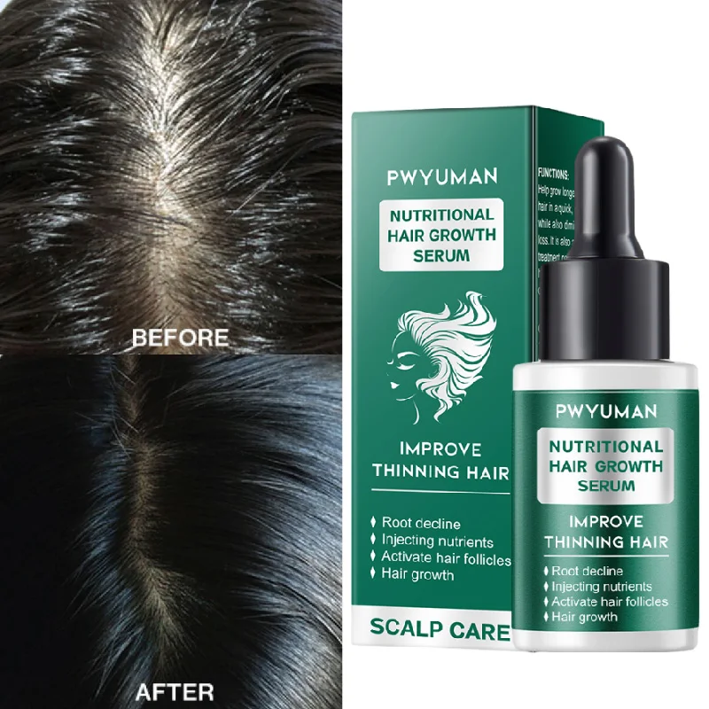 Rapid Hair Growth Serum Effective Hair Loss Protection Repairing Natural Essential Oils Thickening Volumizing Nourish Scalp Care