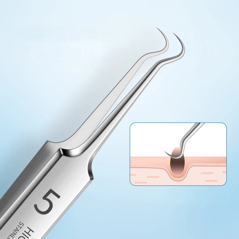 German Ultra-fine No. 5 Cell Pimples Blackhead Clip Tweezers Beauty Salon Special Scraping & Closing Artifact Acne Needle Tool Precision Tweezers Tweezer Tool Pimples Blackhead Tweezers Blackhead Clip Tweezers Cosmetic Tool