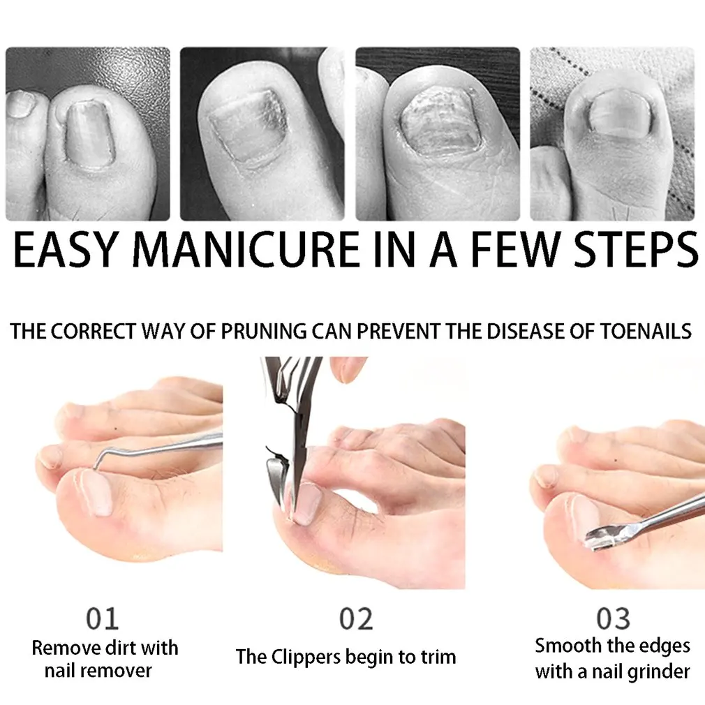 7 Pcs Toenail Clipper Kit for Ingrown, Thick Nails w 2 Year Warranty -  Ingrown Toenail Tool - Professional Podiatrist Heavy Duty Toe Nail Clippers  for Adult Women & Men, Manicure & Pedicure