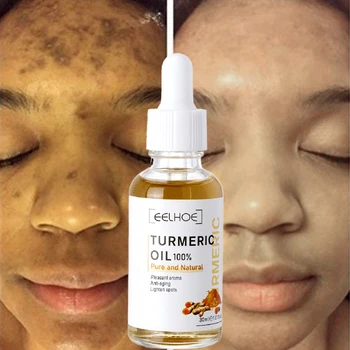 Essence de curcuma pour le visage, élimine les taches, les cicatrices d'acné, éclaircit et éclaircit la peau, élimine les pigments, améliore les soins du visage rugueux