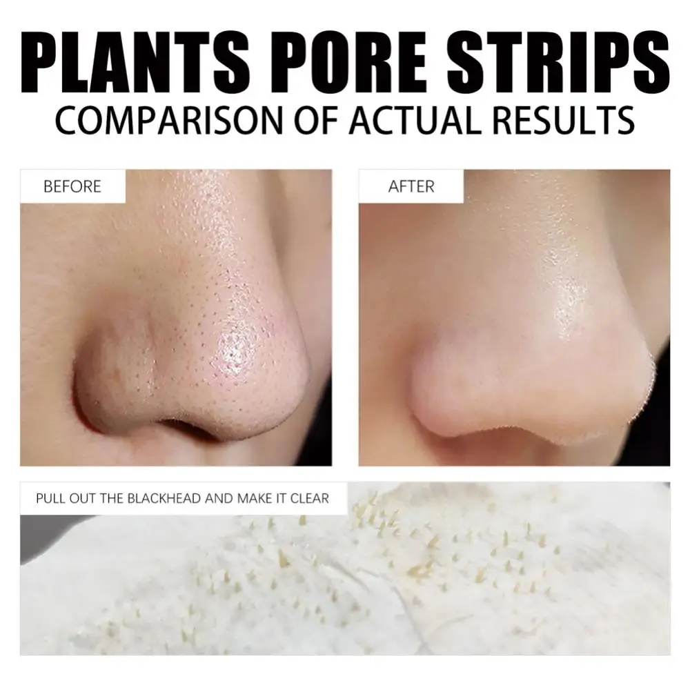 Pore Strips Before And After