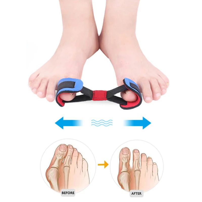 Pexmen Big Toe Strap Bunion Straightener Stretchy Belt Toe Stretcher thumbnail 2