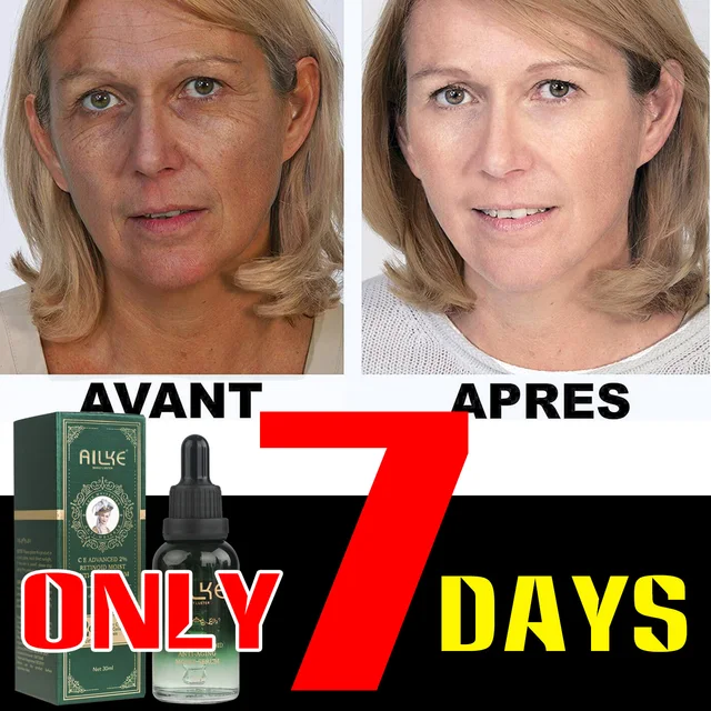 Ailke-Vitaminok C&E Előrehaladott 2% Retinoid Arc Szérum, Öregedésgátló Retinol Szérum A Bőr Ragyogására, Izzó, Hidratáló