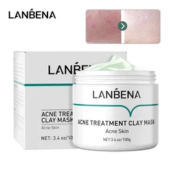 LANBENA Acne Treatment Clay Mask Oligopeptide Acne Masks Mud Face Cream Grease Cleansing Firming Pore Remove Oil Serum Skin Care