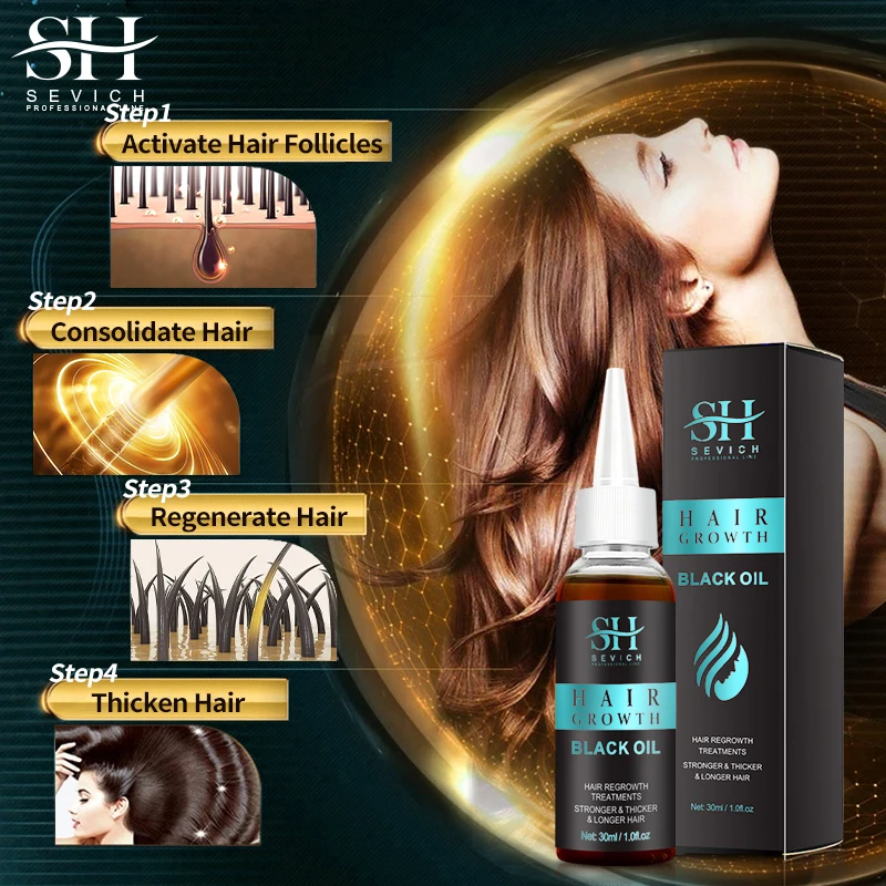 Sevich Natural Ginger Germ Essential Oil Effectively and Rapidly Grows Softens Hair Care Prevent Hair Loss Essential Oil 30ML