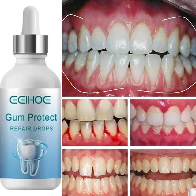 Rapid Repair Gums Serum Effectively Relieve Tooth Allergy Dental Caries Tooth Cleaning Toothpaste Relieve Tooth Damage Drops 2