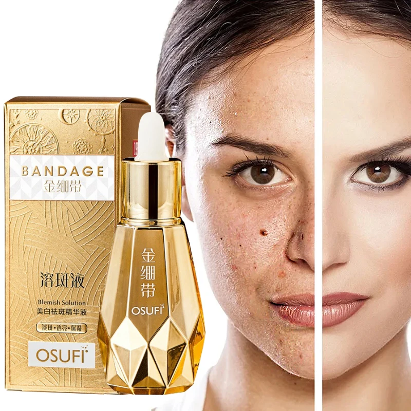 

Whitening Freckle Serum Removing Sun Spots Melasma Lightening Pigmentation Brightening Moisturizing Evenly Skin Care 60ml