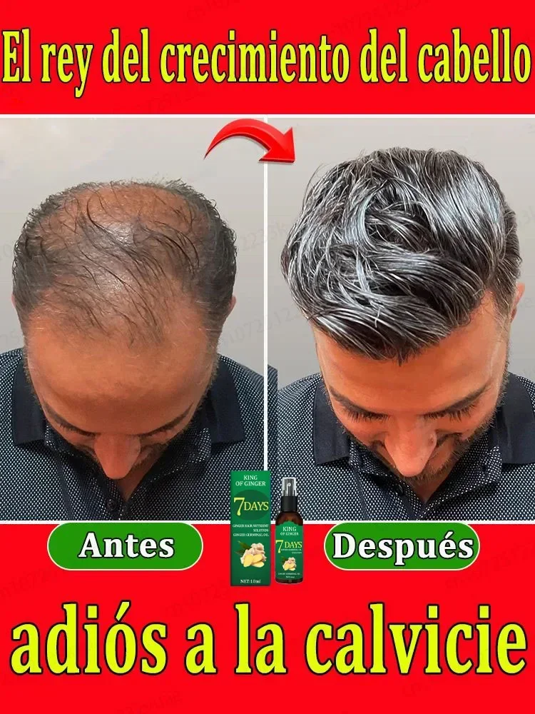 Effective Hair Growth Essential Oil Repairing Baldness and Hair